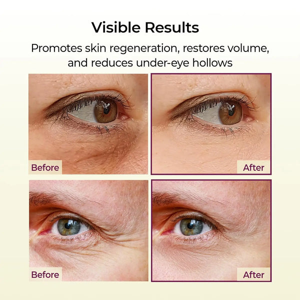 Calcium-Multi-Balm-Stick-Collagen-Elastin-Wrinkle-Stick-All-in-One-Hydrating-Lip-Balm-Eye-Cream.jpg